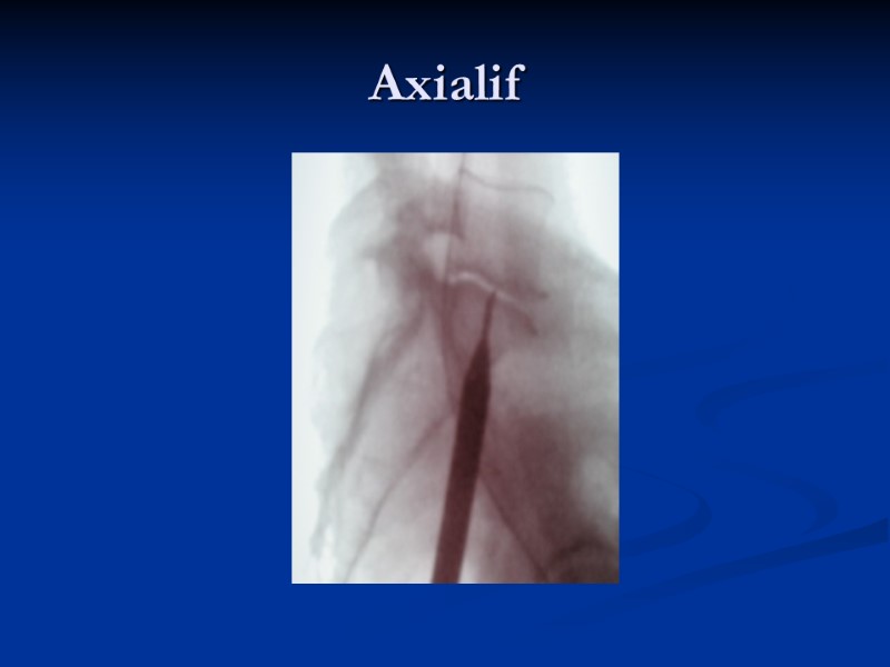 Axialif